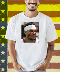 Limted Josh Hart After Getting Elbowed In The Face Shirt