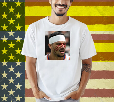 Limted Josh Hart After Getting Elbowed In The Face Shirt