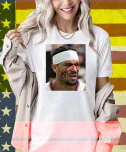 Limted Josh Hart After Getting Elbowed In The Face Shirt