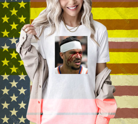 Limted Josh Hart After Getting Elbowed In The Face Shirt