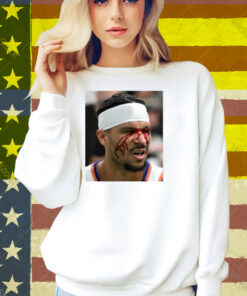 Limted Josh Hart After Getting Elbowed In The Face Shirt