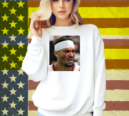 Limted Josh Hart After Getting Elbowed In The Face Shirt
