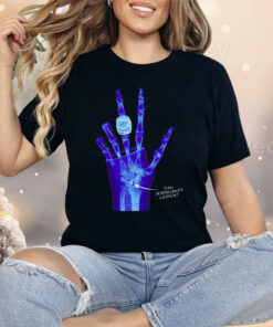 Kobe Bryant LA Lakers X-Ray Broken Torn Scapholunate Ligament Shirt