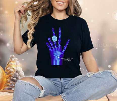 Kobe Bryant LA Lakers X-Ray Broken Torn Scapholunate Ligament Shirt 