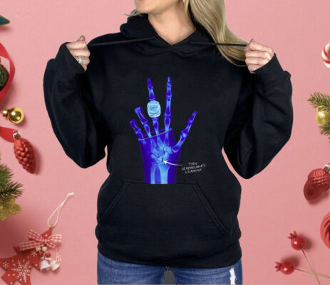 Kobe Bryant LA Lakers X-Ray Broken Torn Scapholunate Ligament Shirt 