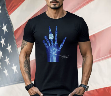 OKC Ring Torn Scapholunate Ligament Shirt