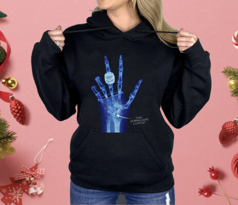 OKC Ring Torn Scapholunate Ligament Shirt